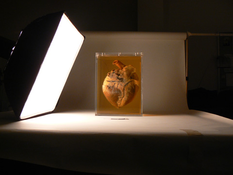The front view of the heart.
