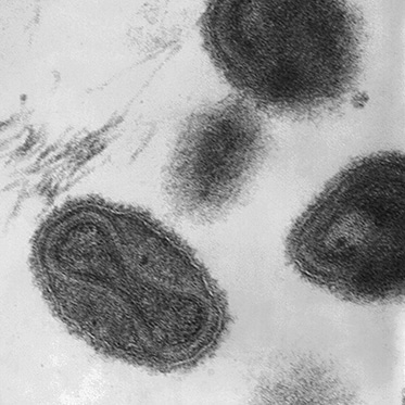 black and white electron microscope image showing five granulated black and white oval shapes on a white background. There is an hour-glass figure discernible in the centre of each shape.