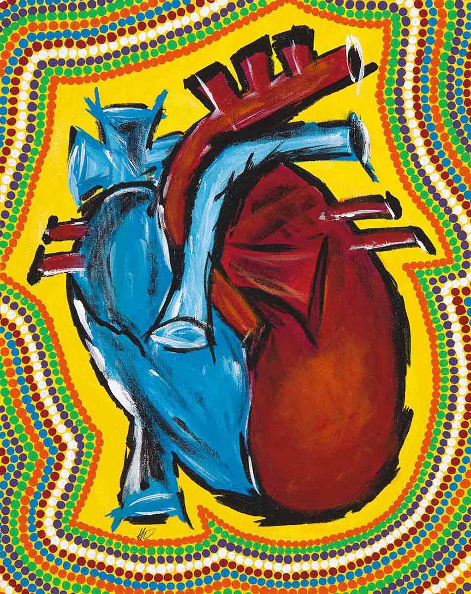 A painting on canvas depicting an anatomical heart in red and blue on a yellow background. Surrounding the heart are lines of coloured dots in orange, green, purple, white, red and blue. - click to view larger image