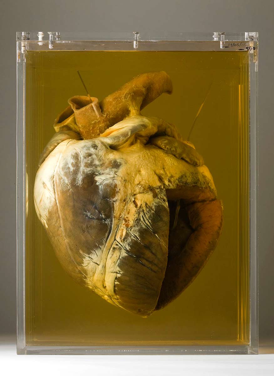 Horses heart suspended in a clear solution in a clear case. The bottom right quarter of the heart has been removed. - click to view larger image