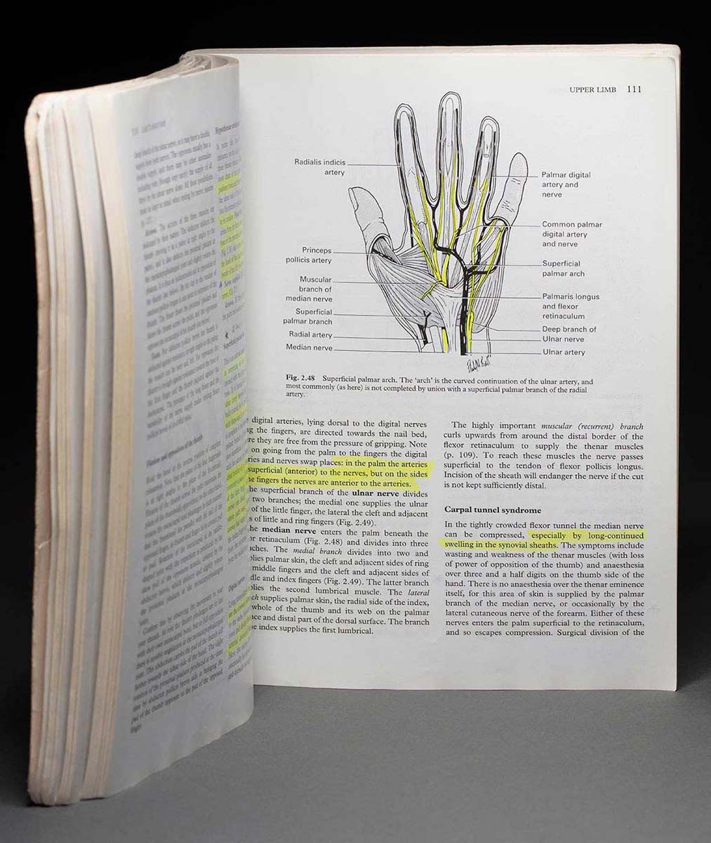An opened book standing upright and parted to a page headed 'Upper Limb' with text (some highlighted in yellow) and a diagram of a hand labelled 'Superficial palmar arch'. The diagram shows nerves and arteries of the hand. - click to view larger image