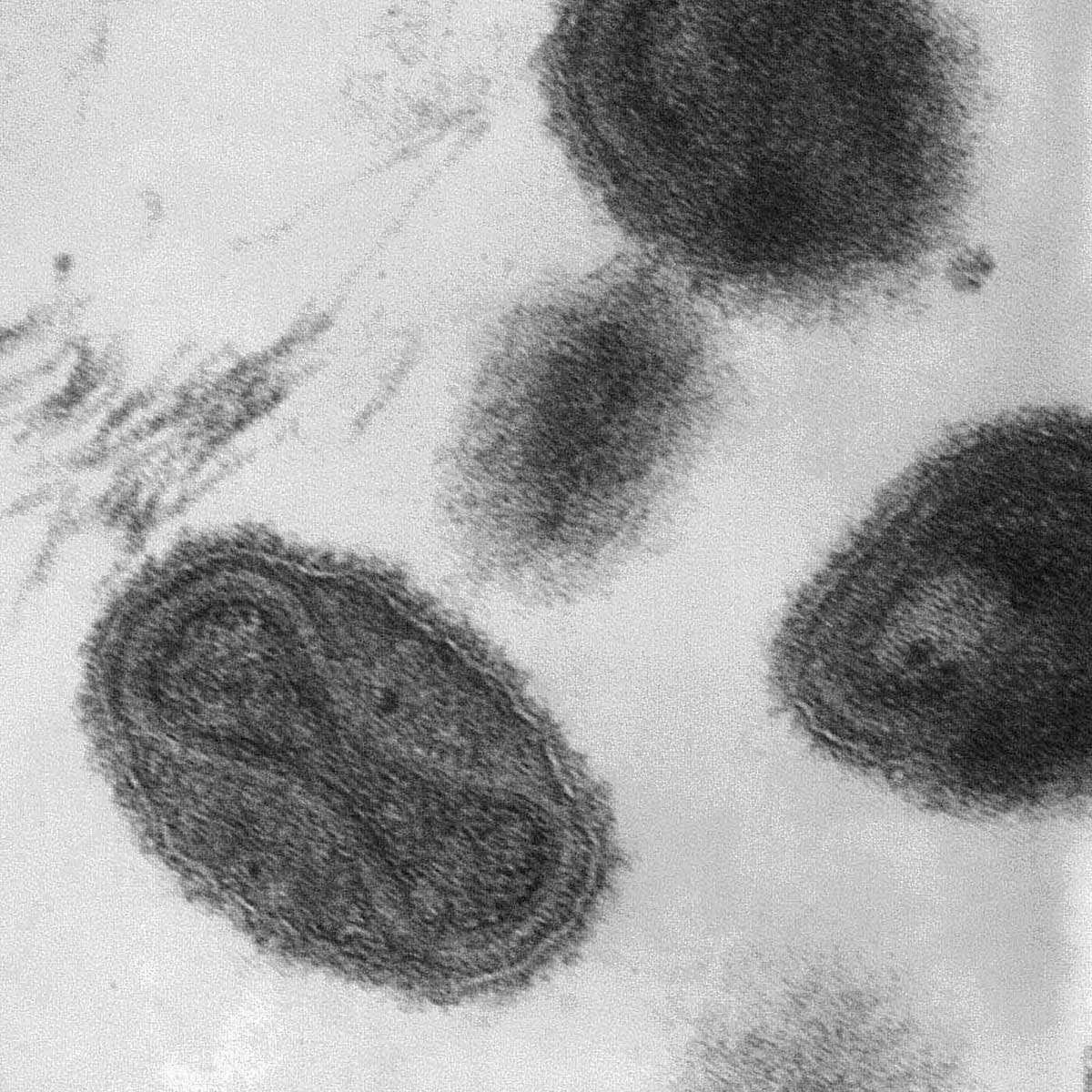 black and white electron microscope image showing five granulated black and white oval shapes on a white background. There is an hour-glass figure discernible in the centre of each shape. - click to view larger image
