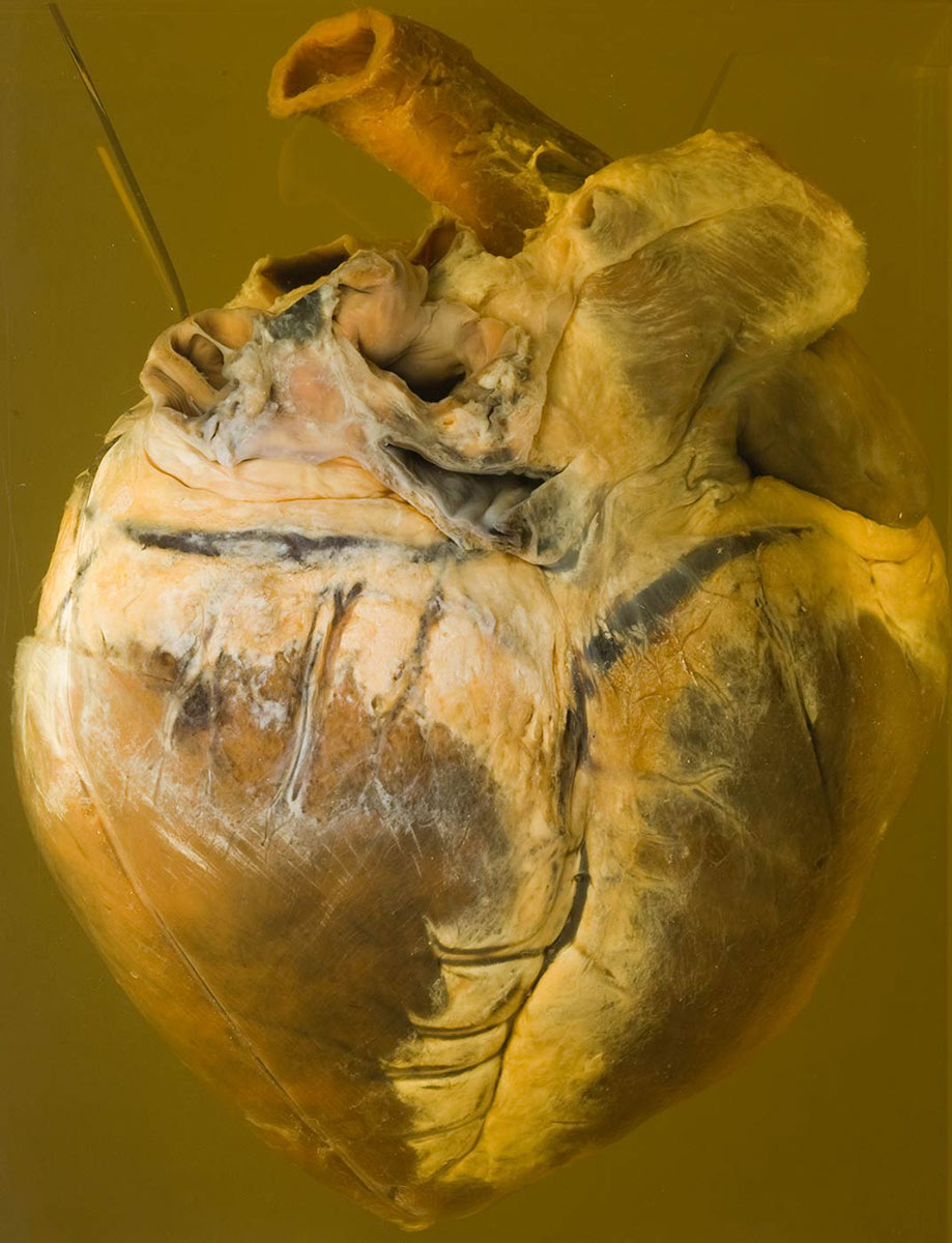 A horse's heart in a container filled with liquid. - click to view larger image