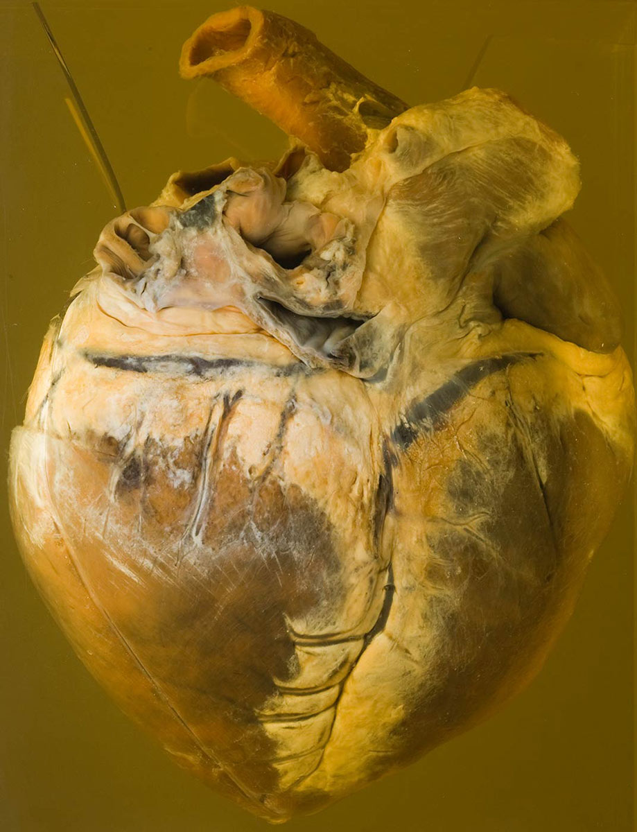 A horse's heart in a container filled with liquid - click to view larger image