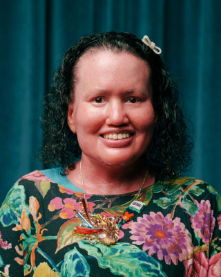 Portrait of Carly Findlay. 