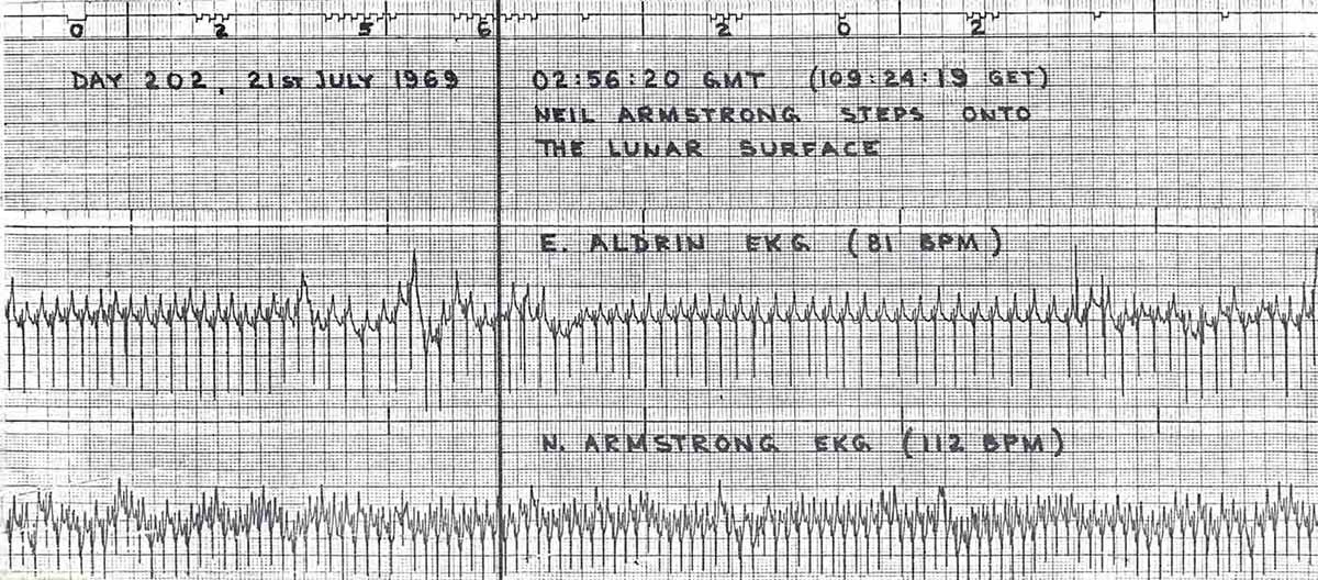 Chart tracking Neil Armstrong’s and Buzz Aldrin’s heart rates the moment they stepped onto the moon.