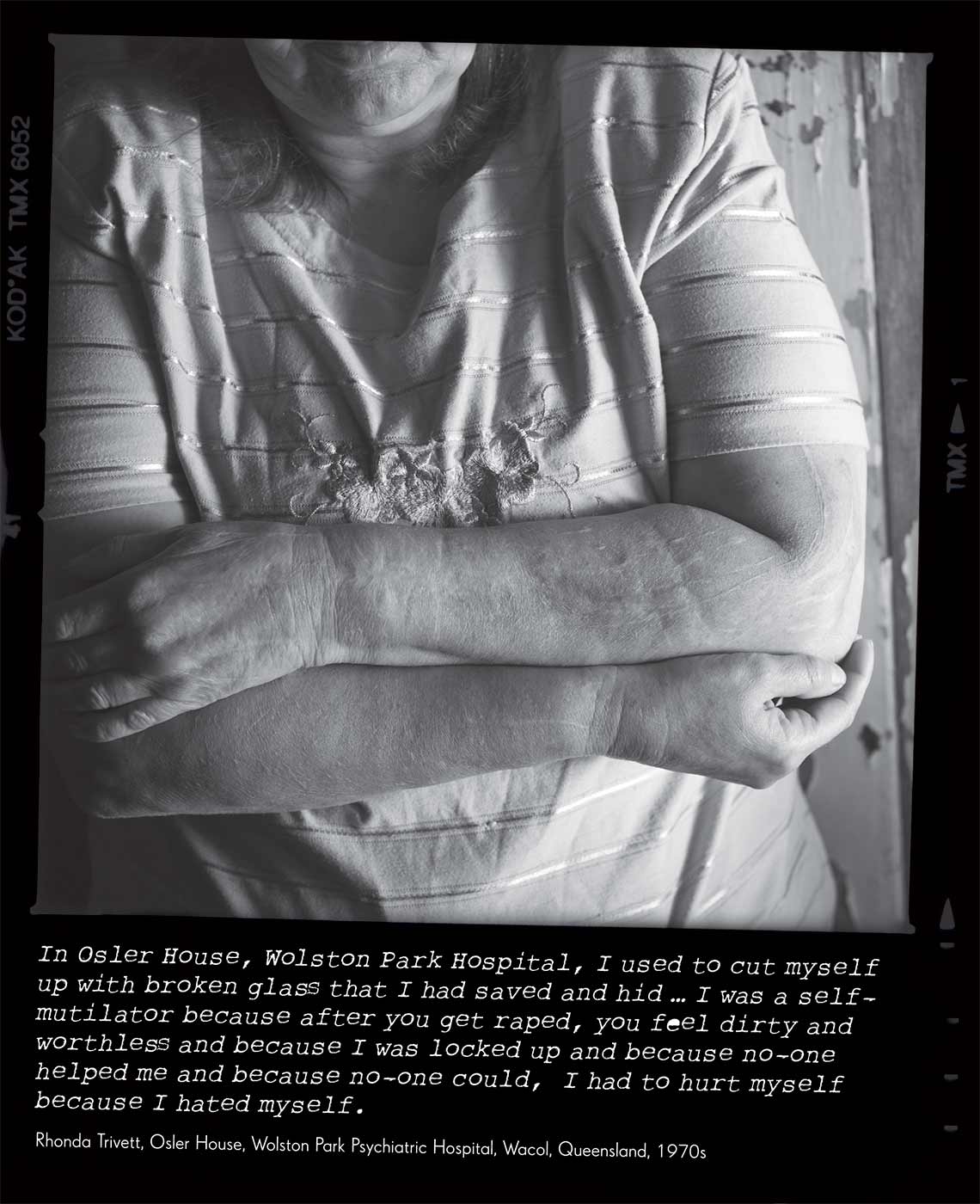 Black and white photo of a woman. She is standing with her arms folded and her face is not visible. The photo caption reads 'In Osler House, Wolston Park Hospital, I used to cut myself up with broken glass that I had saved and hid ... I was a self-mutilator because after you get raped, you feel dirty and worthless and because I was locked up and because no-one helped me and because no-one could, I had to hurt myself because I hated myself' attributed to 'Rhonda Trivett, Osler House, Wolston Park Psychiatric Hospital, Wacol, Queensland, 1970s'. - click to view larger image